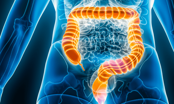 Illustration of a human digestive system features the colon in orange against a blue-toned transparent body, showcasing the product "Consectetur.